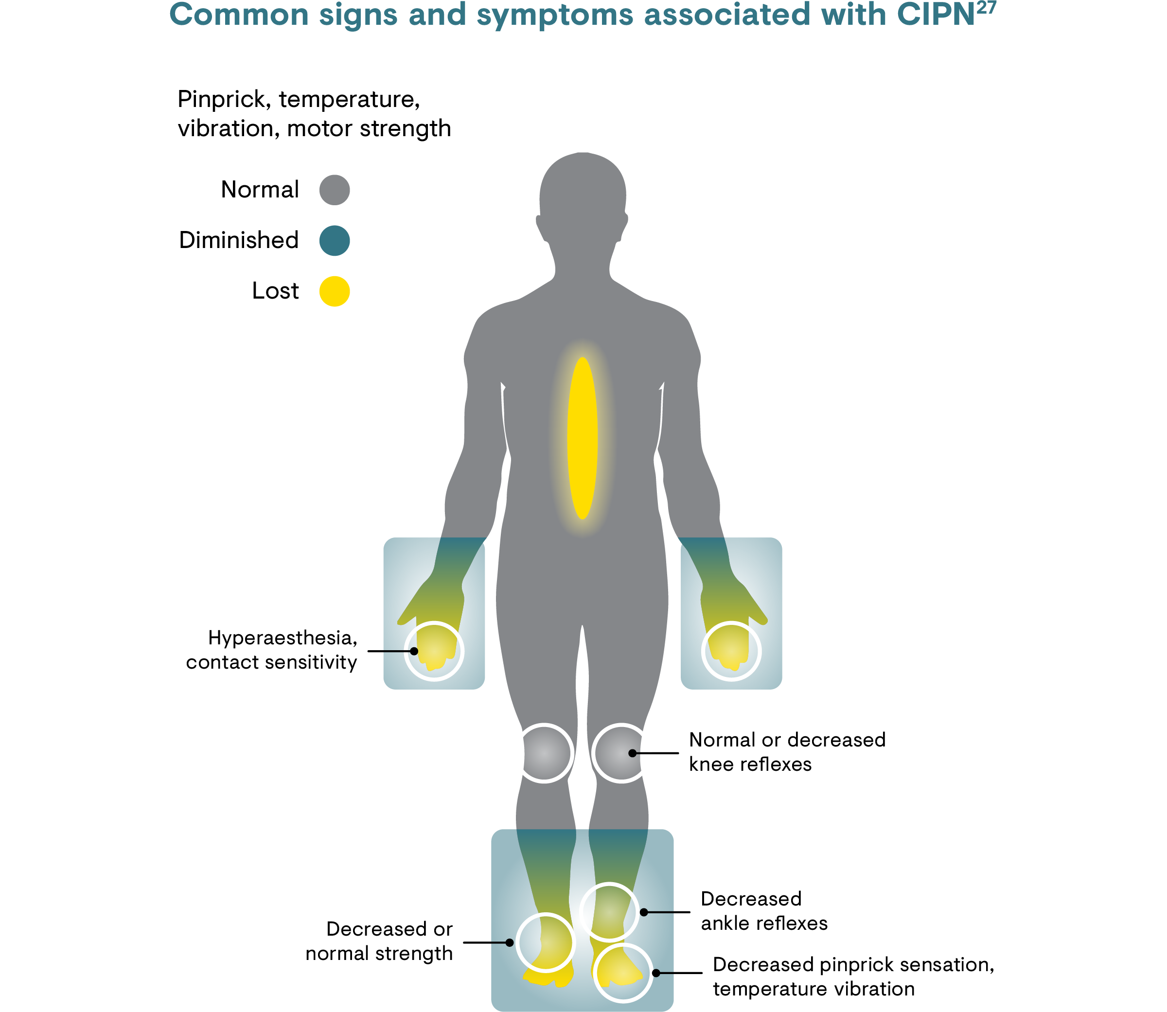 List of common signs and symptoms associated with chemotherapy-induced peripheral neuropathy (CIPN).