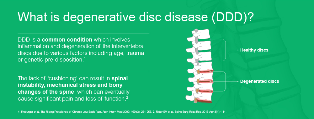 What is degenerative disc disease (DDD ) ?