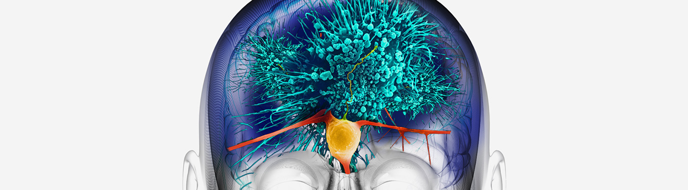 Grünenthal scientific body composing: Therapeutic areas