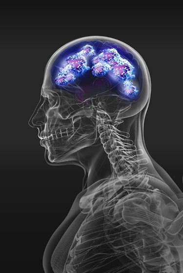 A World Free of Pain - Grünenthal Scientific Body Composing -Skull with molecular structures