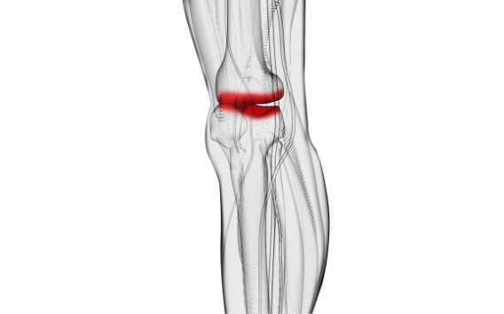 Transform patients’ lives living with Osteoarthritis